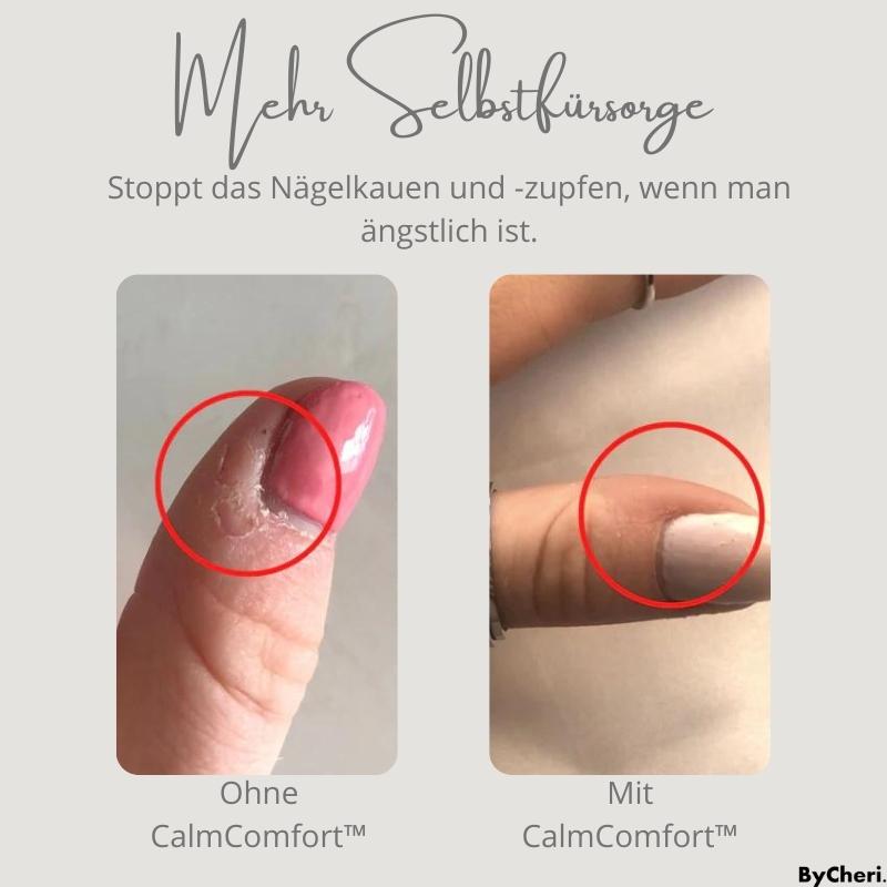 1+1 FREE | CalmComfort™ - Stress Relief Ring