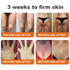 VitaFirm™ - Bee Venom Serum Stick