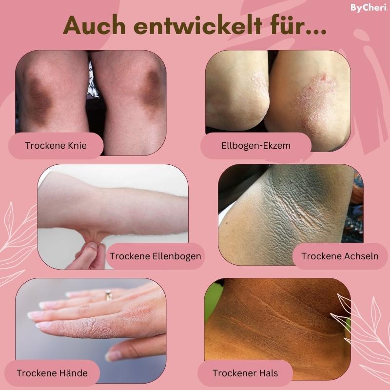 1+1 FREE | FootVitalize™ - Anti-Fungal Cream