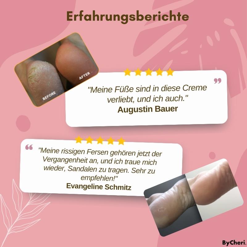 1+1 FREE | FootVitalize™ - Anti-Fungal Cream
