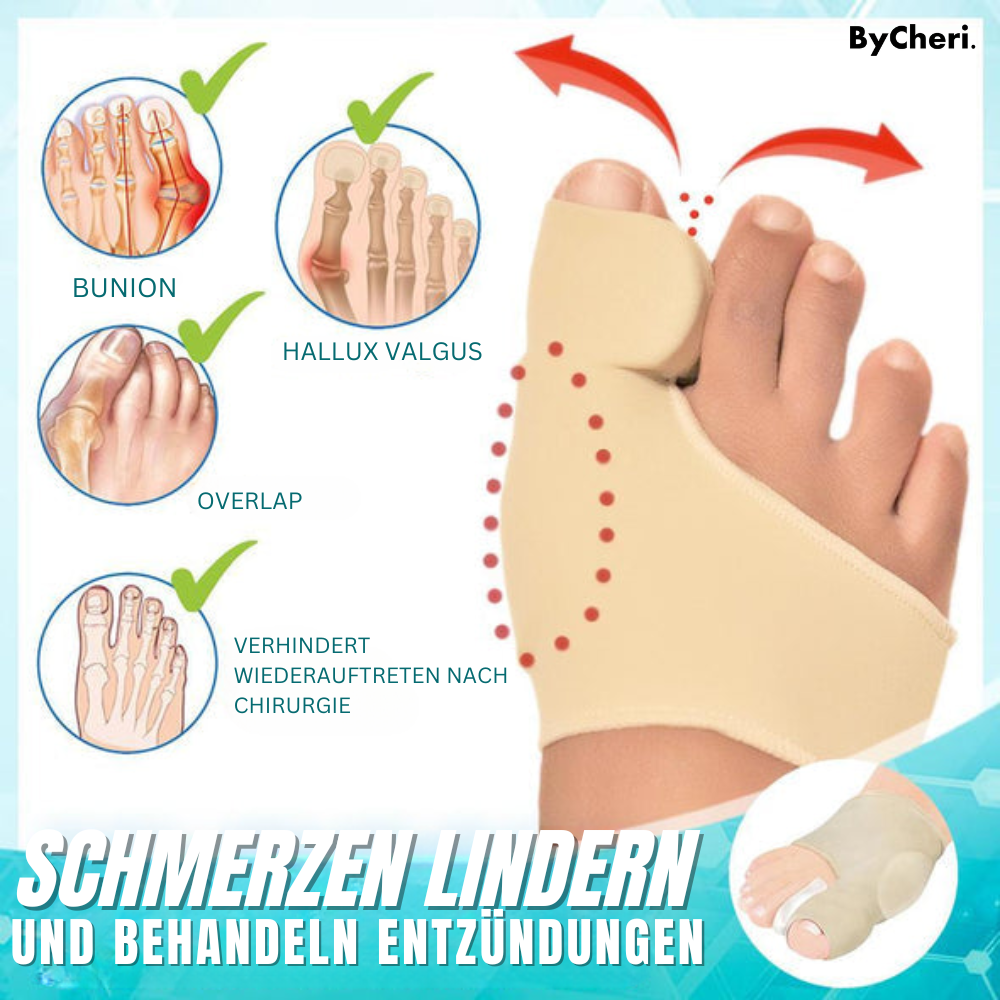 1 + 1 FREE | Dr. Fit™ - Hallux Valgus Correction Sleeves for Pain-Free Relief