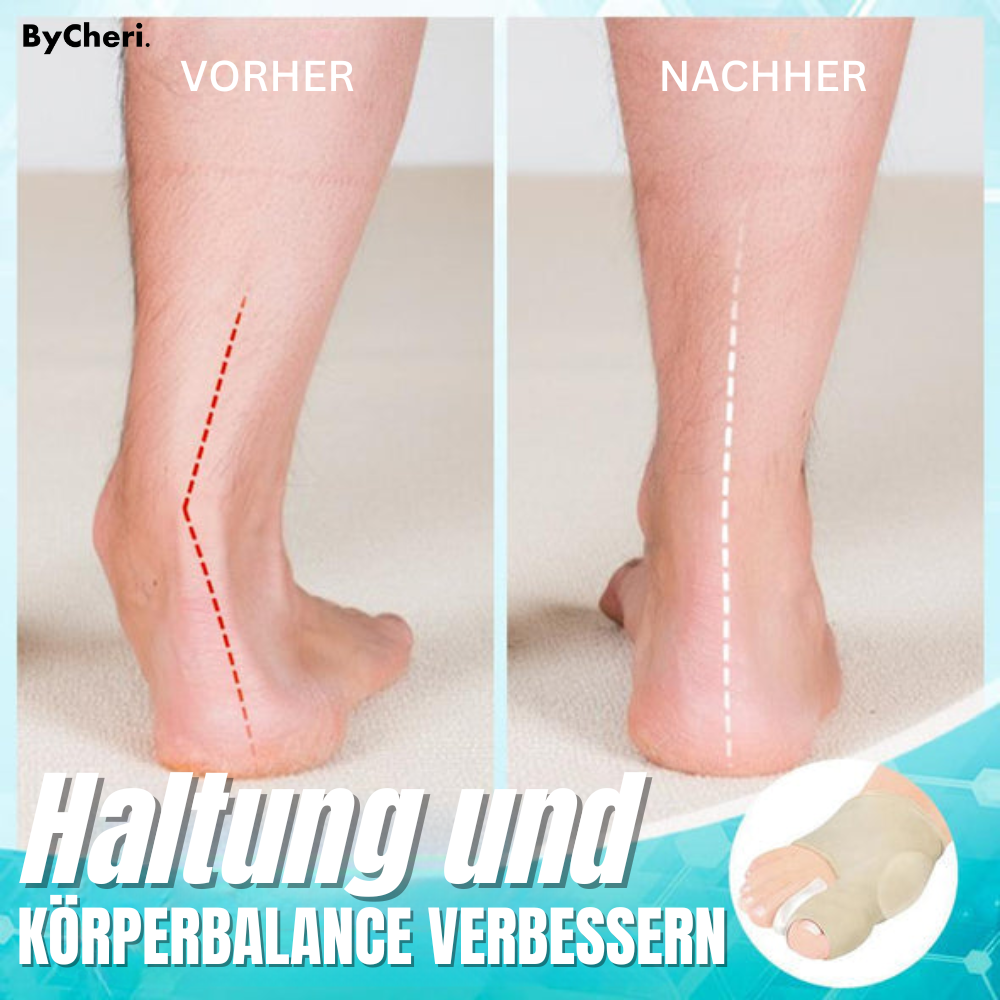 1 + 1 FREE | Dr. Fit™ - Hallux Valgus Correction Sleeves for Pain-Free Relief