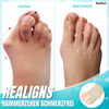 1 + 1 FREE | Dr. Fit™ - Hallux Valgus Correction Sleeves for Pain-Free Relief