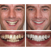 LANTHOME™ | Teeth Whitening Essence - Free  Protected Shipping!