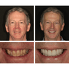 LANTHOME™ | Teeth Whitening Essence - Free  Protected Shipping!