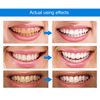 LANTHOME™ | Teeth Whitening Essence - Free  Protected Shipping!