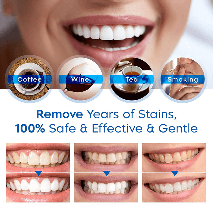 LANTHOME™ | Teeth Whitening Essence - Free  Protected Shipping!