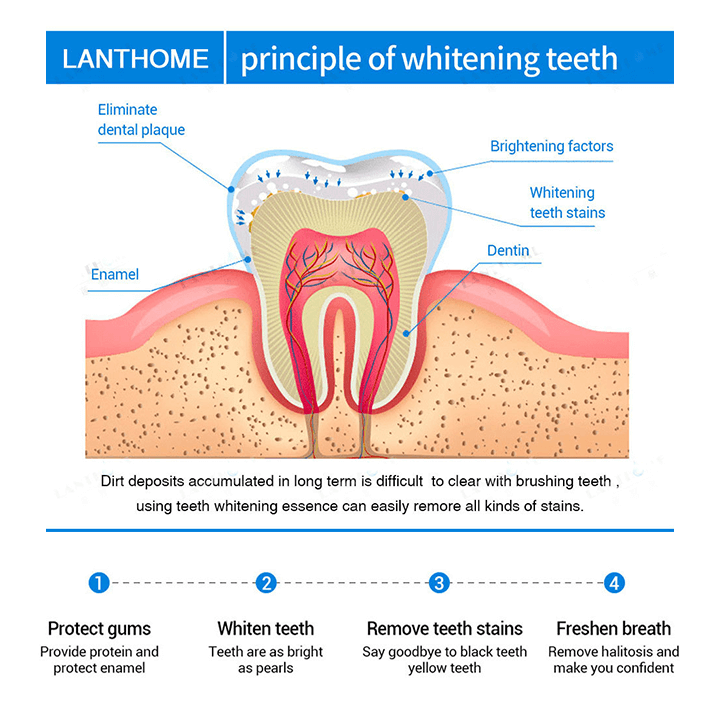 LANTHOME™ | Teeth Whitening Essence - Free  Protected Shipping!