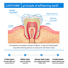 LANTHOME™ | Teeth Whitening Essence - Free  Protected Shipping!