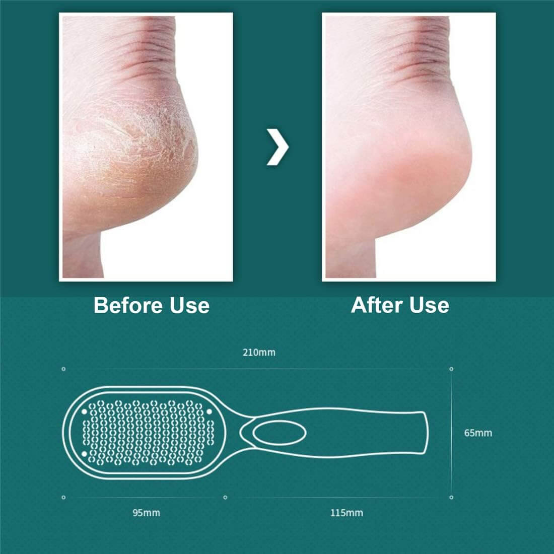 SoleSculpt Pro™